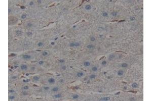 Detection of GPX1 in Human Liver Tissue using Polyclonal Antibody to Glutathione Peroxidase 1 (GPX1)