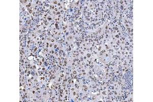 IHC analysis of SCML1 using anti-SCML1 antibody (ABIN7602479). (SCML1 anticorps  (AA 8-322))