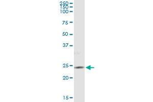 Immunoprecipitation of PIP5K1C transfected lysate using anti-PIP5K1C monoclonal antibody and Protein A Magnetic Bead , and immunoblotted with PIP5K1C MaxPab rabbit polyclonal antibody.