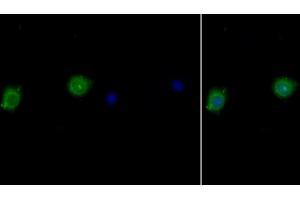 Detection of IL10Ra in Human MCF7 cell using Polyclonal Antibody to Interleukin 10 Receptor Alpha (IL10Ra) (IL-10RA anticorps  (AA 132-235))