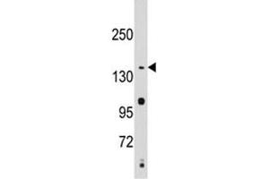 Western blot analysis of SMC2 antibody and Jurkat lysate. (SMC2 anticorps  (AA 1166-1197))