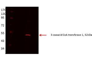OXCT1 antibody - middle region  validated by WB using Proximal kidney tubules purfied from cortex at 1:1000. (OXCT1 anticorps  (Middle Region))