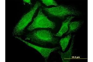 Immunofluorescence of monoclonal antibody to GCH1 on HeLa cell.