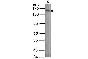 WB Image Sample (30 ug of whole cell lysate) A: A431 , 7.