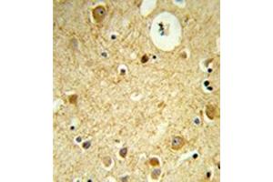 Formalin-fixed and paraffin-embedded human brain tissue reacted with RECK / ST15  Antibody  which was peroxidase-conjugated to the secondary antibody, followed by DAB staining. (RECK anticorps  (Middle Region))