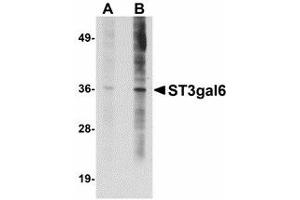 Image no. 1 for anti-ST3 beta-Galactoside alpha-2,3-Sialyltransferase 6 (ST3GAL6) (C-Term) antibody (ABIN478092)