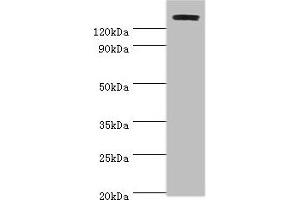 Western blot All lanes: TP53BP2 antibody at 2 μg/mL + Mouse thymus Secondary Goat polyclonal to rabbit IgG at 1/10000 dilution Predicted band size: 126, 112, 127 kDa Observed band size: 126 kDa (TP53BP2 anticorps  (AA 360-600))
