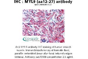 Image no. 1 for anti-Myosin Regulatory Light Chain 2, Smooth Muscle Isoform (MYL9) (AA 12-27) antibody (ABIN1737166) (MYL9 anticorps  (AA 12-27))