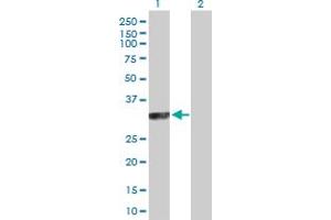 Western Blot analysis of SYCP3 expression in transfected 293T cell line by SYCP3 MaxPab polyclonal antibody. (SYCP3 anticorps  (AA 1-236))