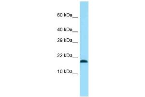 Western Blotting (WB) image for anti-Transmembrane Protein 50B (TM50B) (N-Term) antibody (ABIN2774278) (TMEM50B anticorps  (N-Term))