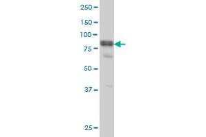 DVL3 monoclonal antibody (M04), clone 4H2 Western Blot analysis of DVL3 expression in A-431 .