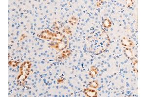 ABIN6267283 at 1/100 staining rat kidney tissue sections by IHC-P.