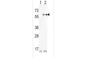Western blot analysis of PIP5K1A (arrow) using rabbit polyclonal hPIP5K1A-R34 (ABIN392593 and ABIN2842123).