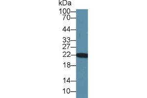 Western blot analysis of Rat Heart lysate, using Rat PARK7 Antibody (1 µg/ml) and HRP-conjugated Goat Anti-Rabbit antibody ( (PARK7/DJ1 anticorps  (AA 1-189))