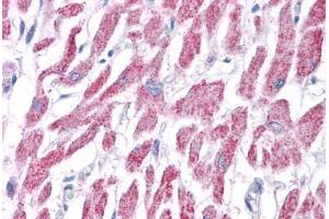 Human Heart: Formalin-Fixed, Paraffin-Embedded (FFPE)