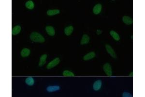 Immunofluorescence analysis of U-2 OS cells using TRIM28 Polyclonal Antibody at dilution of 1:100 (40x lens).