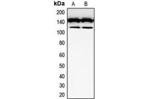 Western blot analysis of CD117 expression in SKNSH (A), Jurkat (B) whole cell lysates. (KIT anticorps  (Center))