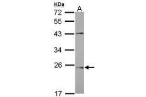 Image no. 1 for anti-Chromosome 1 Open Reading Frame 146 (C1ORF146) (AA 1-180) antibody (ABIN1497028) (C1ORF146 anticorps  (AA 1-180))
