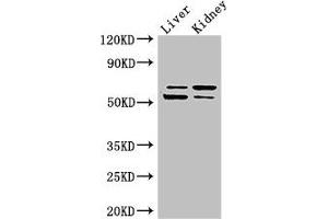 Western Blot Positive WB detected in: Mouse liver tissue, Mouse kidney tissue All lanes: LMBRD1 antibody at 4 μg/mL Secondary Goat polyclonal to rabbit IgG at 1/50000 dilution Predicted band size: 62, 45, 54, 22 kDa Observed band size: 62, 54 kDa (LMBRD1 anticorps  (AA 6-100))