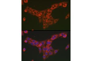 Immunofluorescence analysis of NIH/3T3 cells using Collagen I/COL1 antibody (ABIN6134502, ABIN6138839, ABIN6138840 and ABIN6221469) at dilution of 1:25.