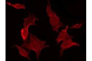 ABIN6275949 staining COLO205 by IF/ICC.