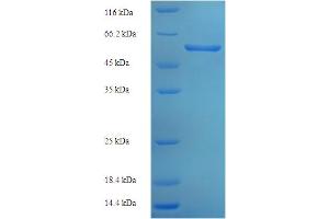 SDS-PAGE (SDS) image for X-Ray Repair Complementing Defective Repair in Chinese Hamster Cells 3 (XRCC3) (AA 1-316), (full length) protein (His-SUMO Tag) (ABIN5710634)