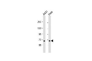 All lanes : Anti-CCD Antibody (N-term) at 1:1000 dilution Lane 1: A431 whole cell lysate Lane 2: Hela whole cell lysate Lysates/proteins at 20 μg per lane.