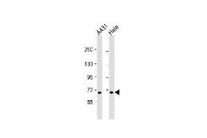 All lanes : Anti-CCD Antibody (N-term) at 1:1000 dilution Lane 1: A431 whole cell lysate Lane 2: Hela whole cell lysate Lysates/proteins at 20 μg per lane. (CCDC120 anticorps  (N-Term))