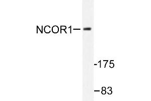 Image no. 1 for anti-Nuclear Receptor Co-Repressor 1 (NCOR1) antibody (ABIN271948) (NCOR1 anticorps)