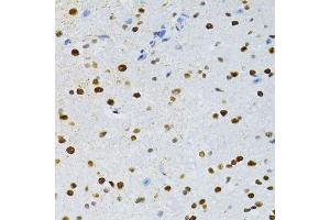 Immunohistochemistry of paraffin-embedded mouse spinal cord using SNRNP70 antibody.