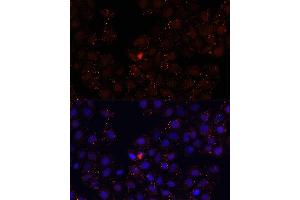 Immunofluorescence analysis of HeLa cells using WDR81 antibody (ABIN6294099) at dilution of 1:100.