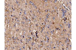 IHC analysis of GPR54/KISS1R using anti-GPR54/KISS1R antibody (ABIN7602153). (KISS1R anticorps  (AA 60-373))