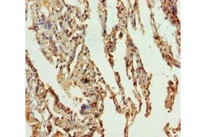 Immunohistochemistry of paraffin-embedded human lung tissue using ABIN7169989 at dilution of 1:100 (Solute Carrier Family 34 (Type II Sodium/phosphate Contransporter), Member 1 (SLC34A1) (AA 1-103) anticorps)