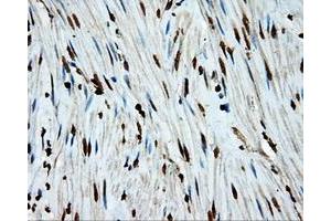 Image no. 4 for anti-Amyloid beta (A4) Precursor Protein (APP) antibody (ABIN1496877) (APP anticorps)
