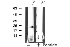 Western blot analysis of extracts from COS cells, using MRPL11 antibody. (MRPL11 anticorps  (Internal Region))