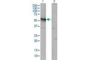 Western Blot analysis of AGT expression in transfected 293T cell line by AGT monoclonal antibody (M01), clone 1A10.