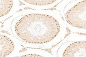 Immunohistochemistry analysis of paraffin-embedded rat testis using,ZCCHC7 (ABIN7076279) at dilution of 1: 3000 (ZCCHC7 anticorps)