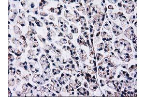 Immunohistochemistry (IHC) image for anti-Catenin (Cadherin-Associated Protein), beta 1, 88kDa (CTNNB1) antibody (ABIN1496893)
