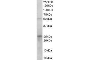Image no. 1 for anti-Hydroxyprostaglandin Dehydrogenase 15-(NAD) (HPGD) (C-Term) antibody (ABIN374495) (HPGD anticorps  (C-Term))
