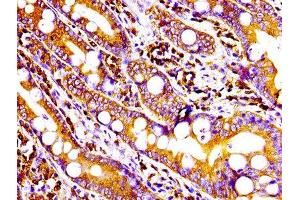 IHC image of ABIN7127286 diluted at 1:100 and staining in paraffin-embedded human small intestine tissue performed on a Leica BondTM system.