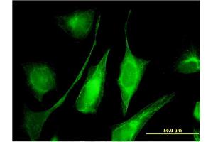 Immunofluorescence of monoclonal antibody to C6orf199 on HeLa cell. (AKD1 anticorps  (AA 321-421))