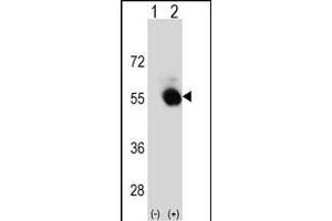 Western blot analysis of SELENBP1 (arrow) using rabbit polyclonal SELENBP1 Antibody (C-term) (ABIN652814 and ABIN2842531).