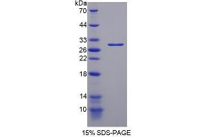 Image no. 1 for Poly (ADP-Ribose) Polymerase 1 (PARP1) (AA 788-1014) protein (His tag) (ABIN4988374) (PARP1 Protein (AA 788-1014) (His tag))