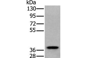 Western blot analysis of Human testis tissue lysate using ZPBP Polyclonal Antibody at dilution of 1:250 (ZPBP anticorps)