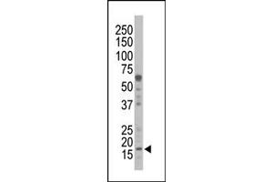 Image no. 1 for anti-Non-Metastatic Cells 1, Protein (NM23A) Expressed in (NME1) (N-Term) antibody (ABIN360544) (NME1 anticorps  (N-Term))