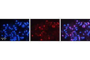 MXD4 antibody - N-terminal region          Formalin Fixed Paraffin Embedded Tissue:  Human Lung Tissue    Observed Staining:  Nucleus of pneumocytes   Primary Antibody Concentration:  1:100    Other Working Concentrations:  1/600    Secondary Antibody:  Donkey anti-Rabbit-Cy3    Secondary Antibody Concentration:  1:200    Magnification:  20X    Exposure Time:  0. (MXD4 anticorps  (N-Term))