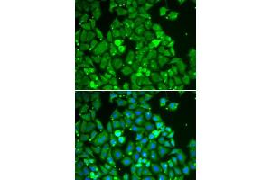 Immunofluorescence analysis of HeLa cells using STAT1 antibody (ABIN5998976). (STAT1 anticorps)