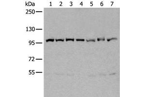 Western blot analysis of 231 Hela A549 A431 HEPG2 Jurkat and K562 cell lysates using VCP Polyclonal Antibody at dilution of 1:400 (VCP anticorps)