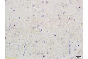 Formalin-fixed and paraffin embedded rat brain tissue labeled with Rabbit Anti-Nociceptin receptor Polyclonal Antibody  at 1:200 followed by conjugation to the secondary antibody and DAB staining. (OPRL1 anticorps  (AA 1-47))
