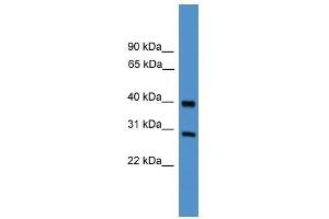 TIMP2 antibody used at 0. (TIMP2 anticorps  (Middle Region))